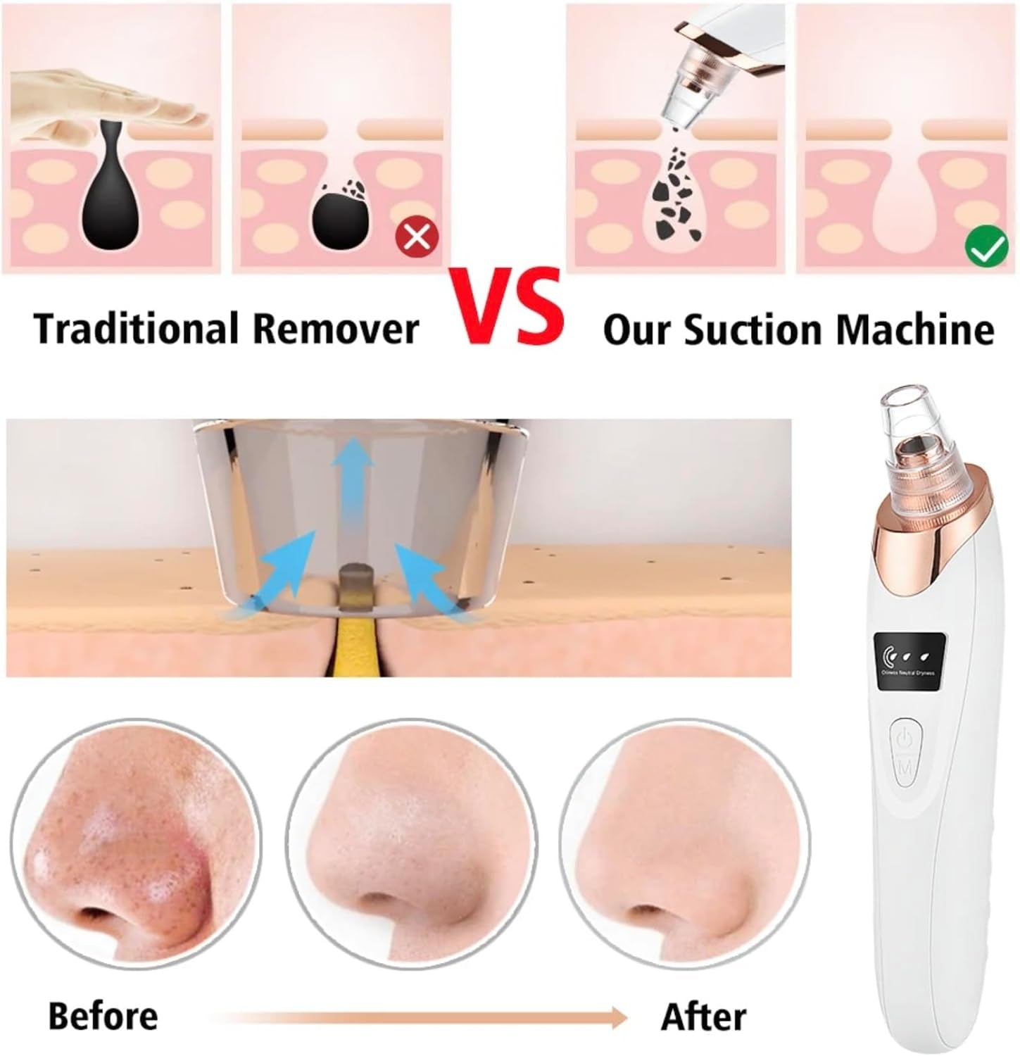 2024 Blackhead Remover Pore Vacuum,Facial Pore Cleaner-5 Suction Power,5 Probes,Usb Rechargeable Blackhead Vacuum Kit Electric Acne Extractor Tool for Adult (White)